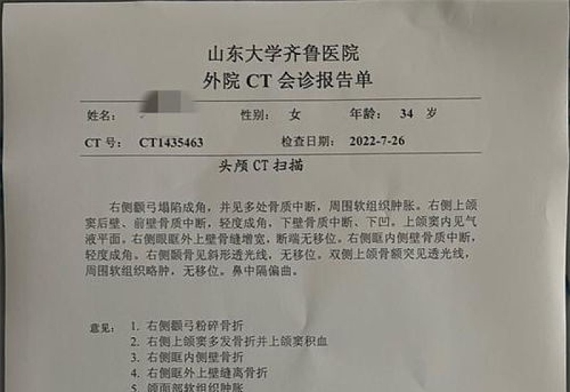 达州参加团建工伤认定标准是什么？